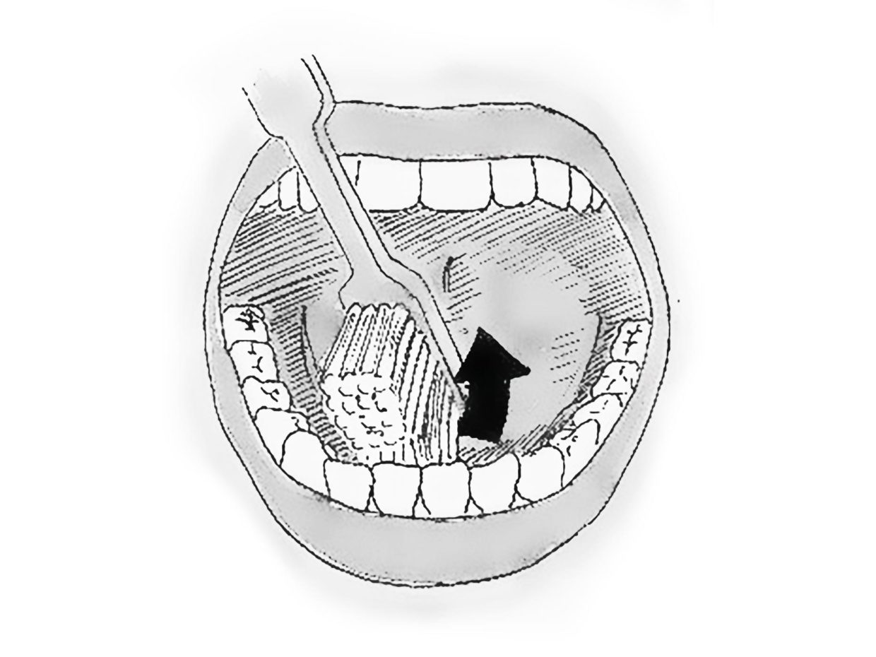 Cómo cepillarse los dientes delanteros